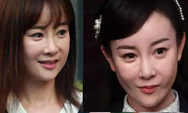 孙菲菲整容后无戏可拍_娱乐圈整容女明星名单_娱乐圈没整过容的明星